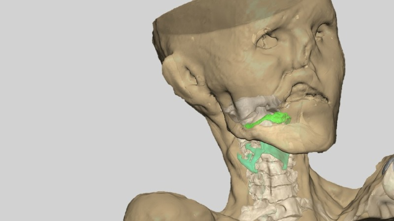 Italian scientists reconstructed Ötzi the Iceman’s vocal tract. (Image: Rolando Fustos)